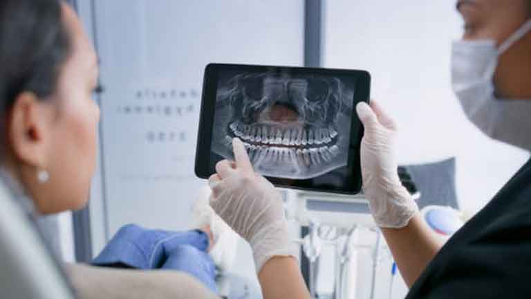 Dental X-Rays