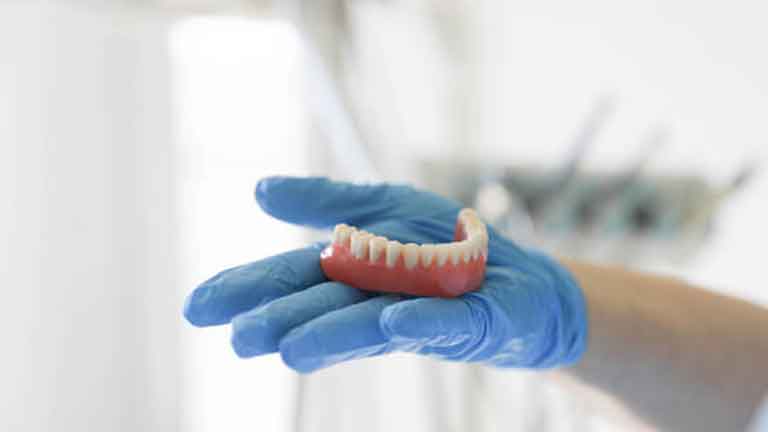 Full Arch Implants